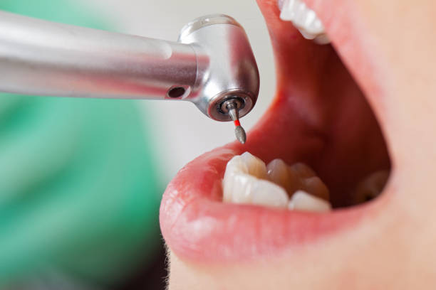 Best Emergency TMJ Treatment in Dano, CO